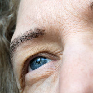 eyelids_232664718 tunge øyelokk